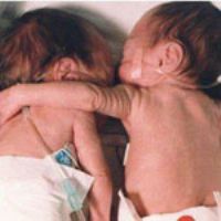 حادثه تلخ در مشهد: زن 36 ساله نوزادان دوقلويش را کشت